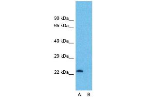 Host:  Rabbit  Target Name:  ATF3  Sample Type:  OVCAR-3  Lane A:  Primary Antibody  Lane B:  Primary Antibody + Blocking Peptide  Primary Antibody Concentration:  1ug/ml  Peptide Concentration:  5ug/ml  Lysate Quantity:  25ug/lane/lane  Gel Concentration:  0. (ATF3 抗体  (Middle Region))