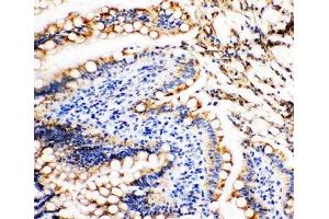 IHC-P: Vinculin antibody testing of rat intestine tissue (Vinculin 抗体  (AA 173-188))
