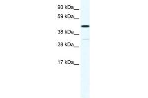 Western Blotting (WB) image for anti-Homeobox A3 (HOXA3) antibody (ABIN2461607)