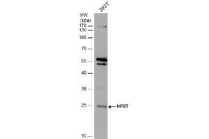 WB Image HPRT antibody detects HPRT protein by western blot analysis. (HPRT1 抗体)
