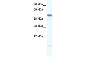 WB Suggested Anti-ZMAT1 Antibody Titration: 0. (ZMAT1 抗体  (Middle Region))