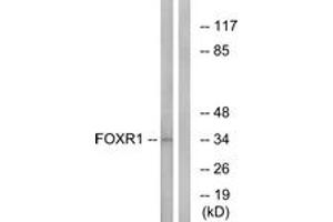 Western blot analysis of extracts from HeLa cells, using FOXR1 Antibody. (FOXR1 抗体  (AA 231-280))