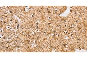 Immunohistochemistry of paraffin-embedded Human brain using ARHGEF5 Polyclonal Antibody at dilution of 1:50 (ARHGEF5 抗体)