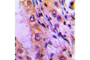 Immunohistochemistry (IHC) image for anti-ATP Synthase, H+ Transporting, Mitochondrial F0 Complex, Subunit E (ATP5I) antibody (ABIN7302810)