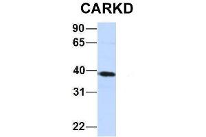 Host:  Rabbit  Target Name:  CARKD  Sample Type:  Jurkat  Antibody Dilution:  1. (Carkd 抗体  (Middle Region))