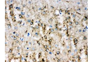 Alpha Internexin was detected in paraffin-embedded sections of rat brain tissues using rabbit anti- Alpha Internexin Antigen Affinity purified polyclonal antibody (Catalog # ) at 1 µg/mL. (INA 抗体  (AA 71-161))