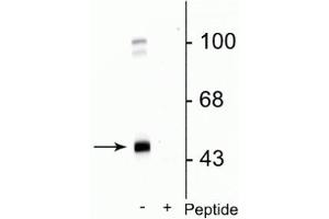 Western blot of rat cortical lysate showing specific immunolabeling of the ~45 kDa GABAA γ2 protein phosphorylated at Ser327 in the first lane (-). (GABRG2 抗体  (pSer327))