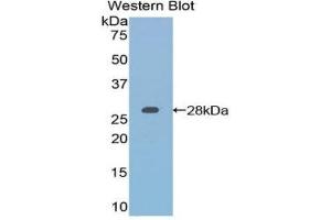 Western Blotting (WB) image for anti-Retinoic Acid Receptor, alpha (RARA) (AA 237-459) antibody (ABIN1860408) (Retinoic Acid Receptor alpha 抗体  (AA 237-459))