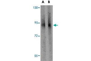Western blot analysis of GLE1 in mouse brain tissue lysate with GLE1 polyclonal antibody  at (A) 1 and (B) 2 ug/mL . (GLE1 抗体  (C-Term))