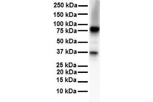 WB Suggested Anti-CPEB4 antibody Titration: 1 ug/mL Sample Type: Human Daudi (CPEB4 抗体  (N-Term))