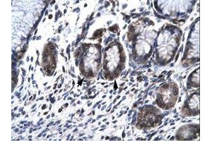 Image no. 1 for anti-Hematopoietic Cell-Specific Lyn Substrate 1 (HCLS1) (AA 28-77) antibody (ABIN6735791) (HCLS1 抗体  (AA 28-77))