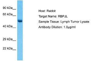 Host: Rabbit Target Name: RBPJL Sample Type: Lymph Tumor lysates Antibody Dilution: 1. (RBPJL 抗体  (N-Term))