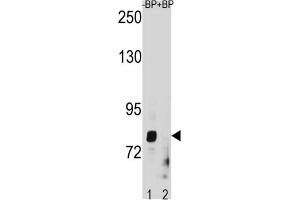 Western Blotting (WB) image for anti-Zinc Finger, Matrin-Type 1 (ZMAT1) antibody (ABIN3004468) (ZMAT1 抗体)