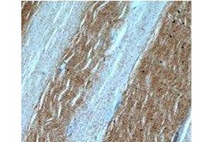 Immunohistochemical of paraffin-embedded human skeletal muscle using (LDHA antibody) at dilution of 1:50. (Lactate Dehydrogenase A 抗体)