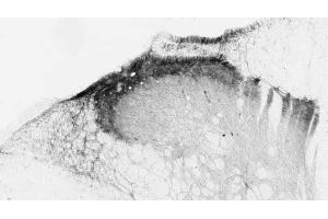 Adult rat spinal cord dorsal horn immunohistochemistry.