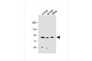 All lanes : Anti-MUT Antibody (Center) at 1:2000 dilution Lane 1: Human liver lysate Lane 2: Mouse liver lysate Lane 3: K562 whole cell lysate Lysates/proteins at 20 μg per lane. (MUT 抗体  (AA 492-526))