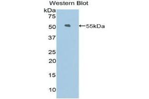 Western Blotting (WB) image for anti-Kinesin Family Member 5A (KIF5A) (AA 823-1027) antibody (ABIN1859531) (KIF5A 抗体  (AA 823-1027))