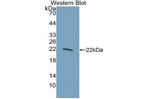 Western Blotting (WB) image for anti-Glucokinase (Hexokinase 4) Regulator (GCKR) (AA 320-499) antibody (ABIN3206778) (GCKR 抗体  (AA 320-499))