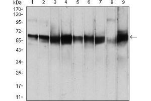 Western Blotting (WB) image for anti-3-phosphoinositide Dependent Protein Kinase-1 (PDPK1) (AA 457-556) antibody (ABIN5542259)