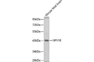 Western blot analysis of extracts of Mouse fetal brain using NPY1R Polyclonal Antibody. (NPY1R 抗体)