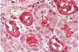 Immunohistochemistry (IHC) image for anti-Solute Carrier Family 14 (Urea Transporter), Member 1 (Kidd Blood Group) (SLC14A1) (AA 119-168) antibody (ABIN6752973)
