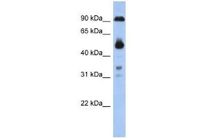 CCDC144B antibody used at 1 ug/ml to detect target protein. (CCDC144B 抗体  (Middle Region))