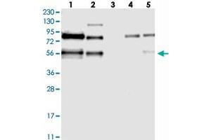 Western blot analysis of Lane 1: RT-4, Lane 2: U-251 MG, Lane 3: Human Plasma, Lane 4: Liver, Lane 5: Tonsil with TJAP1 polyclonal antibody . (TJAP1 抗体)