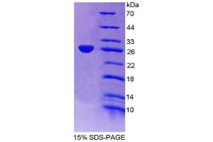 SDS-PAGE (SDS) image for Apolipoprotein A-IV (APOA4) (AA 135-281) protein (His tag) (ABIN1169911)