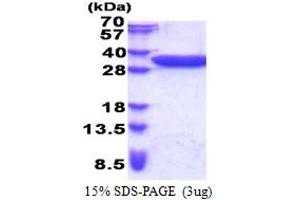 SDS-PAGE (SDS) image for Coiled-Coil Domain Containing 44 (CCDC44) (AA 61-297) protein (His tag) (ABIN5853335) (TACO1 Protein (AA 61-297) (His tag))