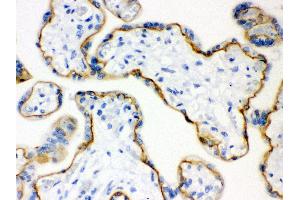 Immunohistochemistry (Paraffin-embedded Sections) (IHC (p)) image for anti-Cadherin 1, Type 1, E-Cadherin (Epithelial) (CDH1) (AA 286-703) antibody (ABIN3043808)