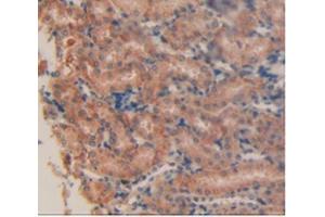 IHC-P analysis of Mouse Kidney Tissue, with DAB staining. (PD-L1 抗体  (AA 34-241))