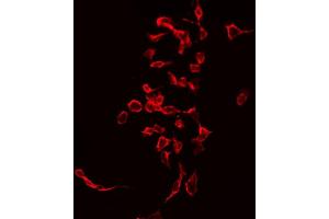 ABIN6268951 staining Hela by IF/ICC. (CD247 抗体  (C-Term))
