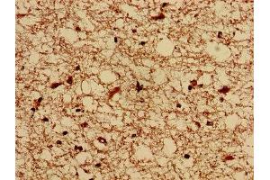 Immunohistochemistry (IHC) image for anti-K(lysine) Acetyltransferase 5 (KAT5) (AA 3-512) antibody (ABIN7155274)