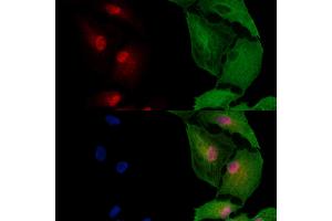 ABIN6262226 and ABIN6272920 staining  cells by IF/ICC.