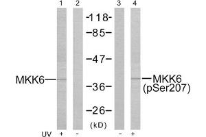 Western blot analysis of the extracts from MDA-MB- 435 cells treated or untreated with UV using MKK3 (epitope around residue 207) Antibody (ABIN5976000) and MKK6 (Phospho-Ser207) Antibody (ABIN59760003). (MAP2K3 抗体  (pSer189, Ser207))