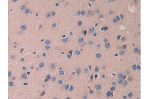 DAB staining on IHC-P; Samples: Mouse Cerebrum Tissue (LAMB2 抗体  (AA 1498-1716))