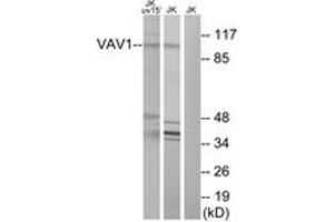 Western Blotting (WB) image for anti-Vav 1 Oncogene (VAV1) (AA 141-190) antibody (ABIN2889078) (VAV1 抗体  (AA 141-190))