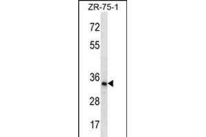 TLCD2 Antibody (C-term) (ABIN656296 and ABIN2845603) western blot analysis in ZR-75-1 cell line lysates (35 μg/lane). (TLCD2 抗体  (C-Term))