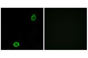 Immunofluorescence analysis of A549 cells, using ABCA13 antibody. (ABCA13 抗体  (Internal Region))
