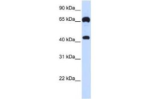 Western Blotting (WB) image for anti-Guanylate Cyclase 1, Soluble, beta 3 (GUCY1B3) antibody (ABIN2458977) (GUCY1B3 抗体)