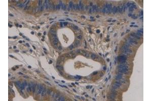 DAB staining on IHC-P; Samples: Mouse Uterus Tissue) (Fibulin 1 抗体  (AA 399-578))