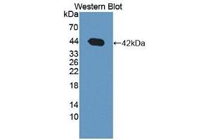Detection of recombinant BDH1 using Polyclonal Antibody to 3-Hydroxybutyrate Dehydrogenase 1 (BDH1)