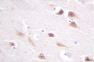 Image no. 2 for anti-Casein Kinase 2, beta (CSNK2B) antibody (ABIN272014) (CSNK2B 抗体)