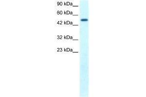 WB Suggested Anti-FLJ14768 Antibody Titration: 1. (FIZ1 抗体  (C-Term))