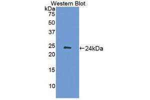 Detection of Recombinant ADCY7, Mouse using Polyclonal Antibody to Adenylate Cyclase 7 (ADCY7) (ADCY7 抗体  (AA 309-491))