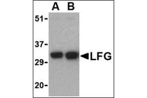 Western blot analysis of LFG in EL4 cell lysate with this product at (A) 0. (FAIM2 抗体  (N-Term))
