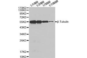 Western blot analysis of HeLa cell using β-tubulin antibody at different dilution. (TUBB 抗体)