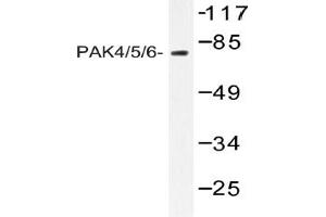 Image no. 1 for anti-P21-Activated Kinase 4 (PAK4) antibody (ABIN317882) (PAK4 抗体)