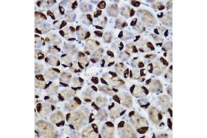Immunohistochemistry (IHC) image for anti-BCL2/adenovirus E1B 19kDa Interacting Protein 3 (BNIP3) (AA 1-164) antibody (ABIN6137620)