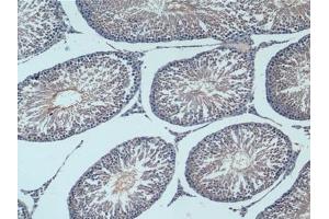 Immunohistochemistry (IHC) image for anti-Enolase 2 (Gamma, Neuronal) (ENO2) (AA 2-434) antibody (ABIN7431956)